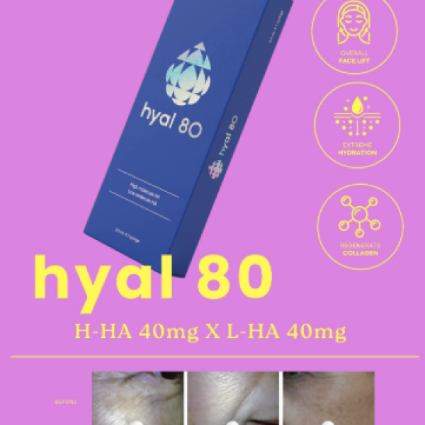 Hyal 80 2.5 ml syringe