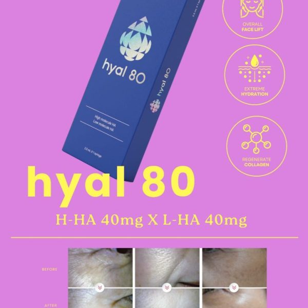 Hyal 80 2.5 ml syringe